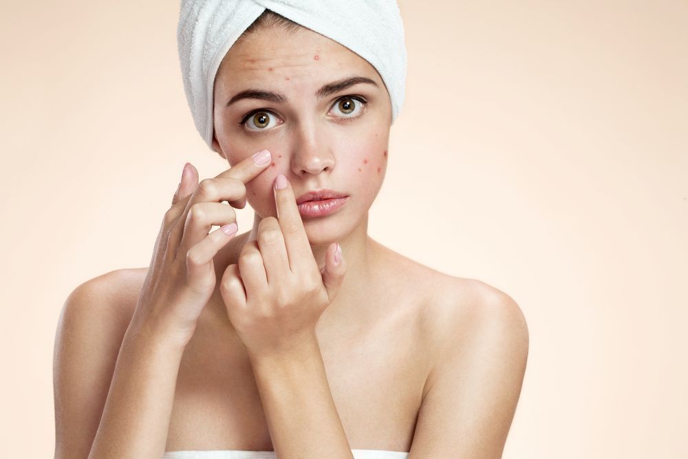 Уход за кожей с акне: как правильно умываться и какие средства выбрать